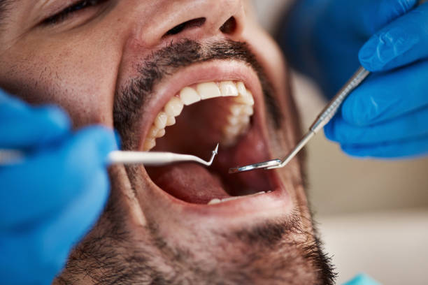Best Full Mouth Reconstruction  in Pittsfield, IL